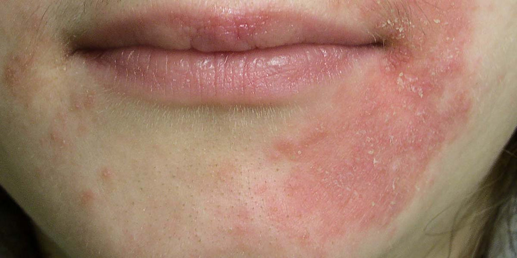Heal Your Skin from the Inside Out | Gut Health & Personalised Skincare